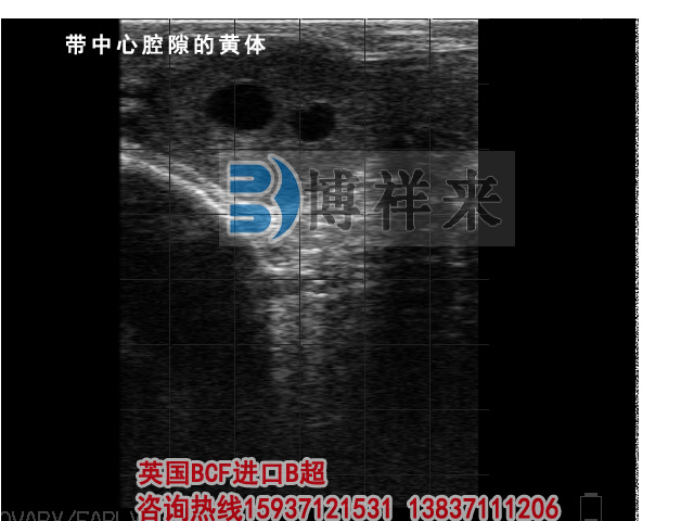 牛用B超檢測帶中心腔隙黃體影像圖